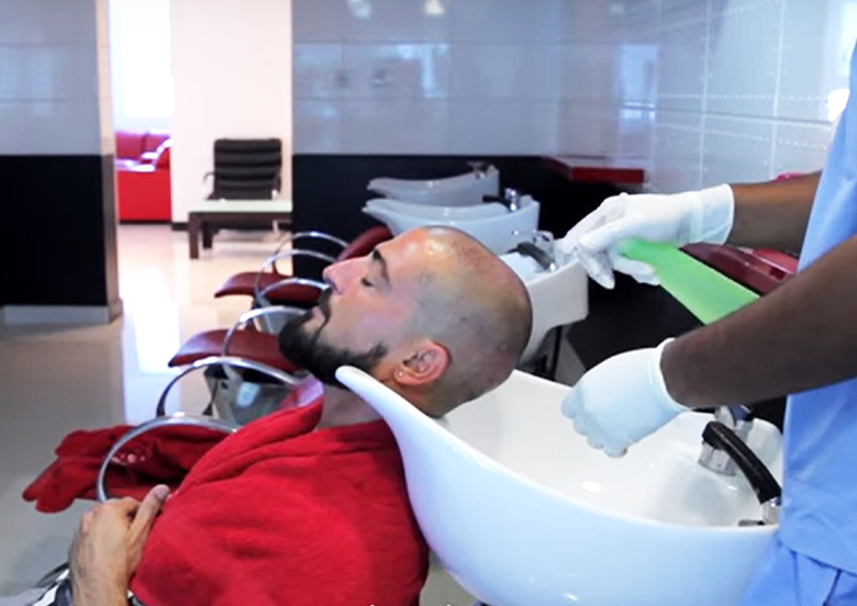 delhi-clinic dhi-delhi-hair-transplant