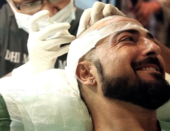 dhi-web-2 Hair Transplant Cost in Bangalore India