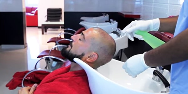 Hair Transplant Cost in Canada