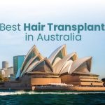 Hair Transplant