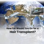 Hair Transplant