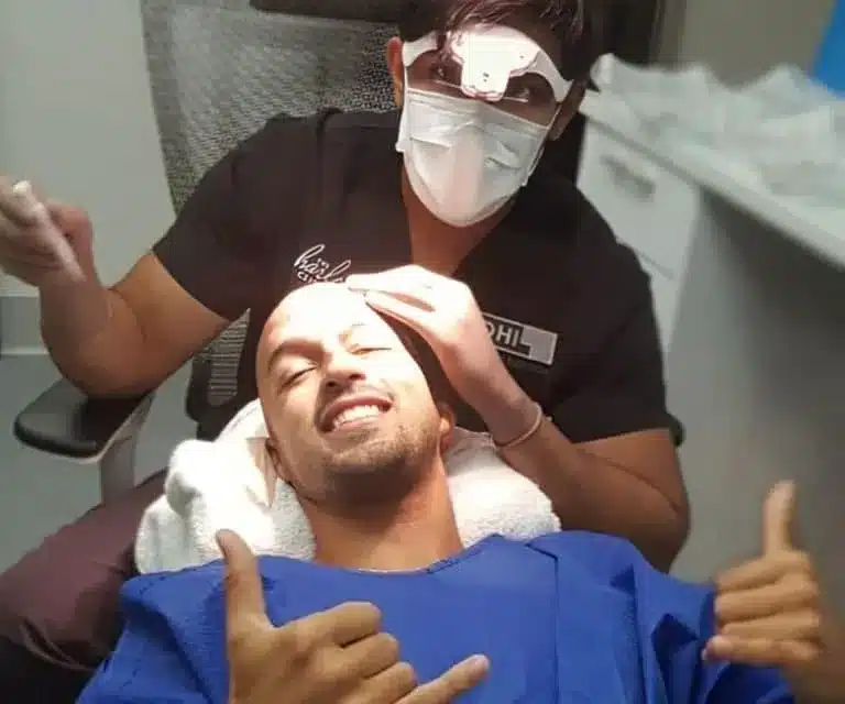 DIRECT HAIR IMPLANTATION